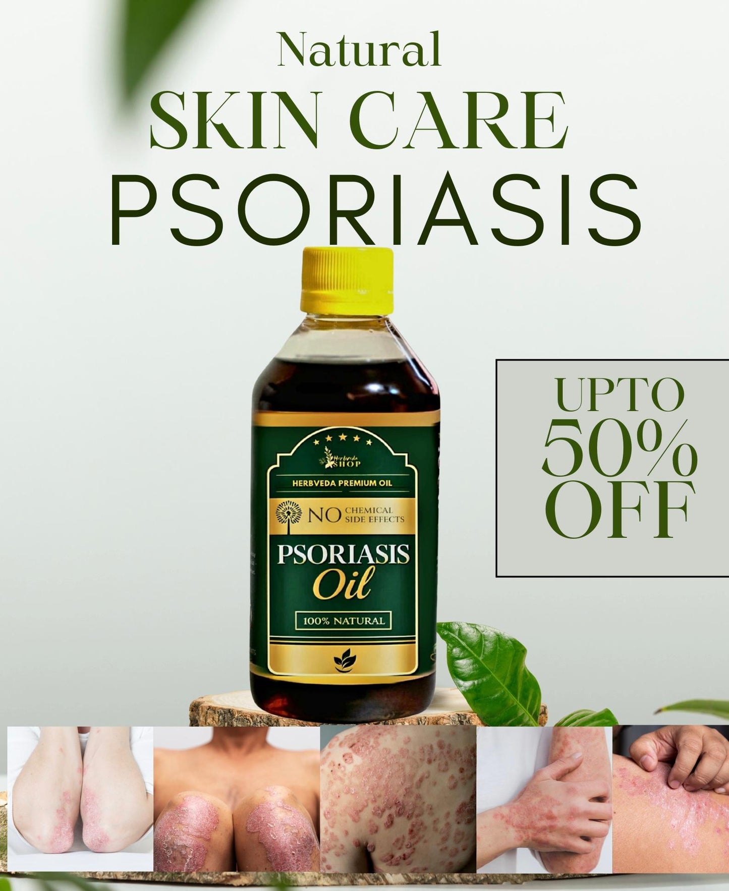 Herbveda Psoriasis -Clearing Oil