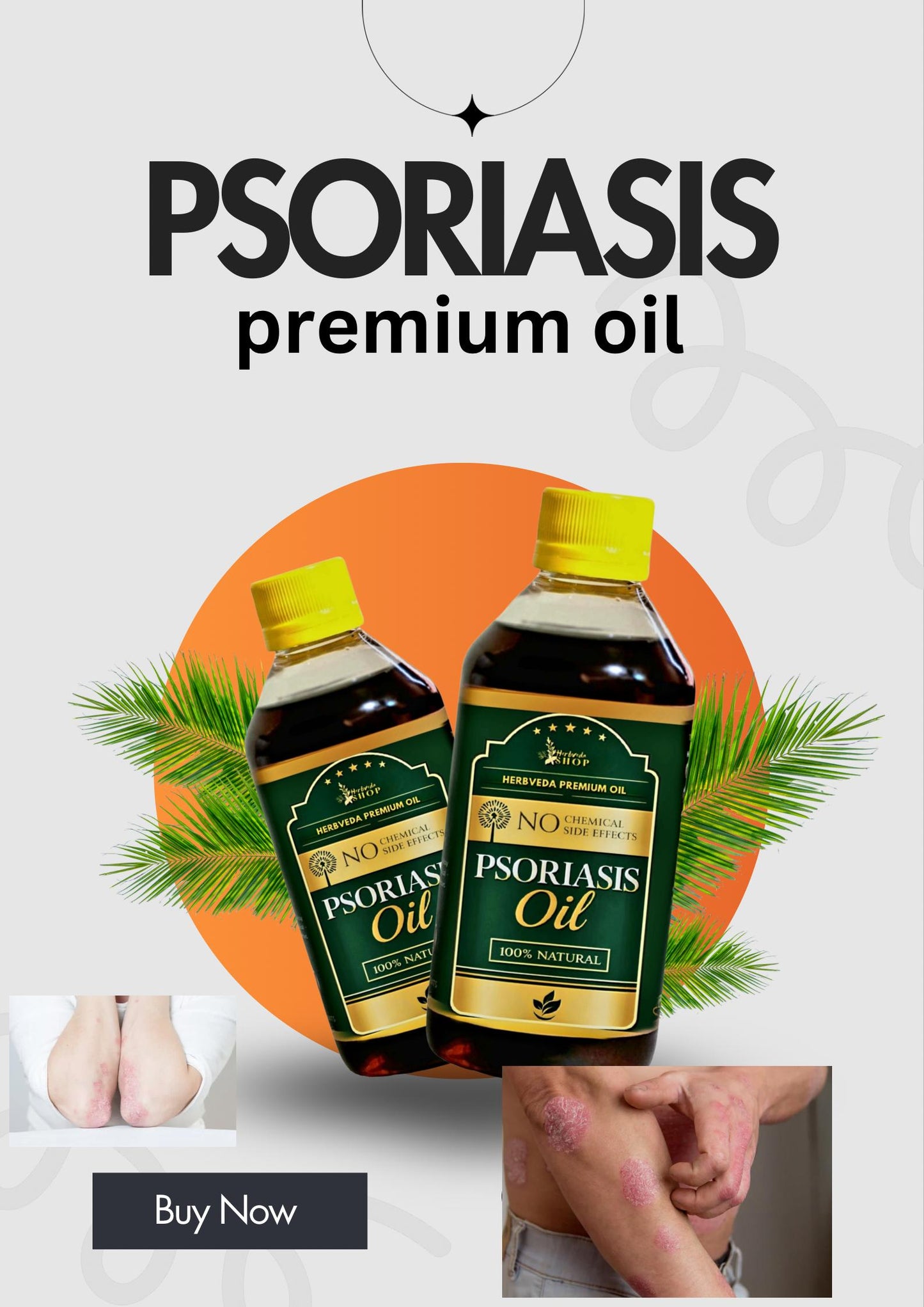 Herbveda Psoriasis -Clearing Oil
